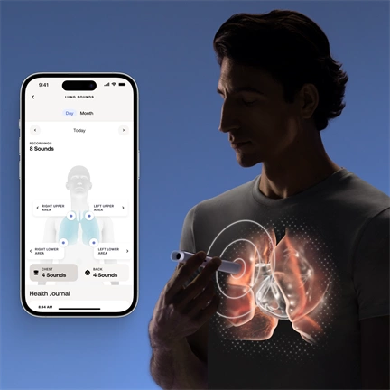 Withings Beam-O 4-in-1 health MultiScan - Fehér