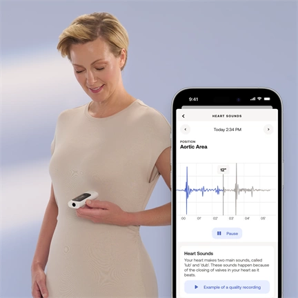 Withings Beam-O 4-in-1 health MultiScan - Fehér